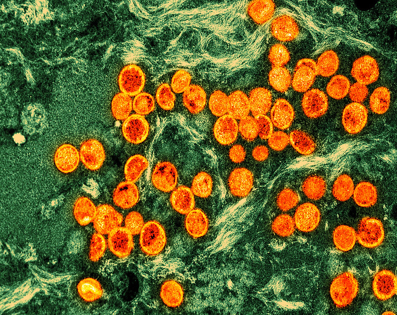 mpox virus orange